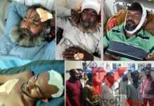 મોરબી જિલ્લાના હળવદના ટીકર ગામે થયેલ મારામારીના બનાવમાં પોલીસે વ્હાલા દવલાની નીતિ અપનાવી વહીવટ કર્યો હોવાની ચર્ચા..જુઓ વીડીયો